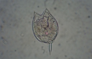 microscope-zoom-sample-small.JPG